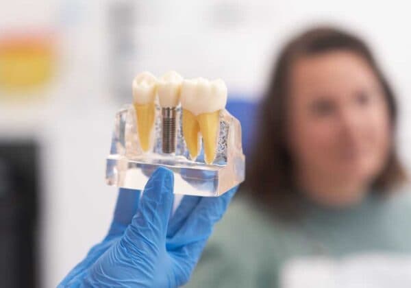 Implanty dentystyczne — przewodnik po zabiegach